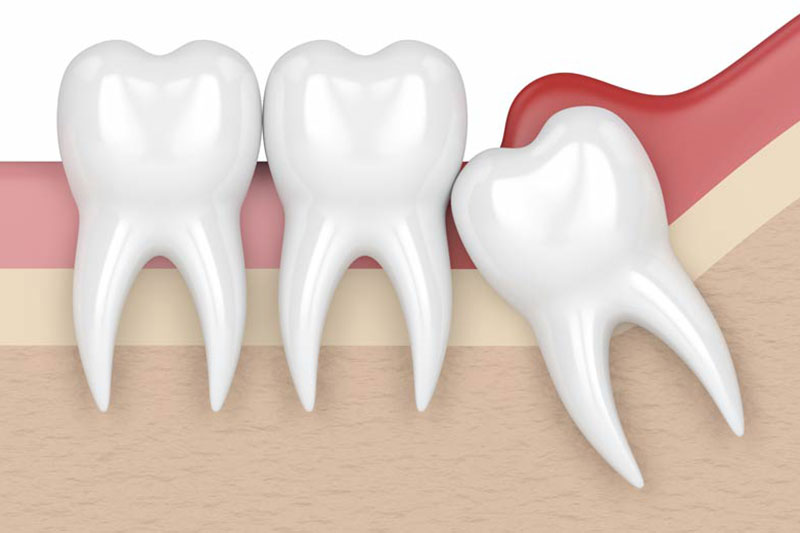 Quality Dental Treatments in Crofton
